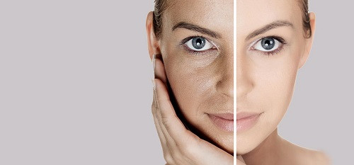 Bí quyết trị nám da không thể dễ hơn từ đậu đỏ