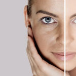 Bí quyết trị nám da không thể dễ hơn từ đậu đỏ