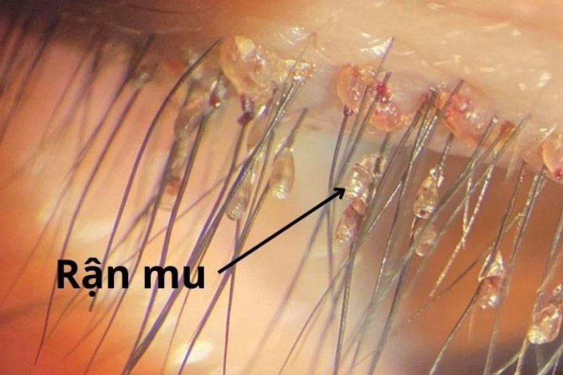 Hình ảnh minh họa