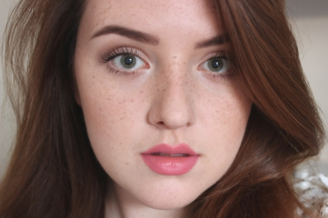 Kem trị tàn nhang và kem trị nám giống hay khác nhau? | Blog Trị Nám