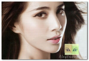 Giới thiệu 3 công nghệ trị nám hiệu quả bằng tia laser