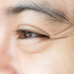 Lão hóa sớm – 9 nguyên nhân khiến da lão hóa mà bạn chưa biết