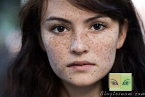 Mặt nạ trị nám hiệu quả từ bột gỗ đàn hương