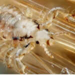 Con rận (rận mu) là gì? Nguyên nhân, triệu chứng, cách điều trị