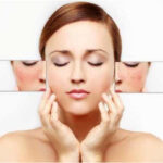 Loại kem trị nám tốt nhất hiện nay chị em khuyên dùng